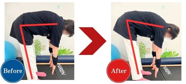 年齢による背骨の変形で前屈がしにくかった女性が、痛みなく前屈出来るように